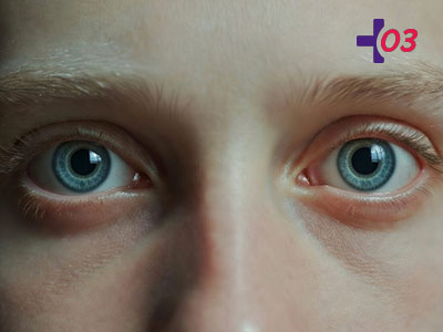 Расширенные зрачки крупным планом
